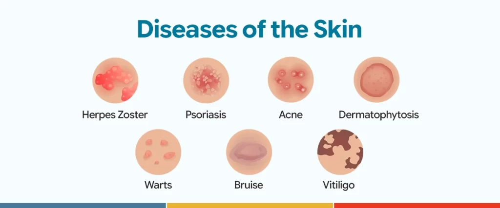 Best Skin Doctor in Chittagong 4 Diseases of the Skin copy