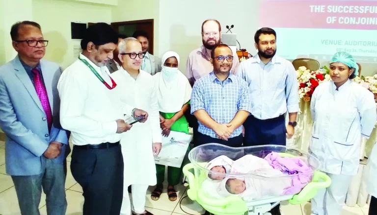 আলাদা করা হলো জন্মগতভাবে জোড়া লাগানো জমজ শিশুকে