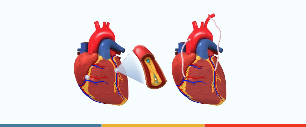 Best cardiovascular surgery doctor in Chittagong 3 cardiovuscular